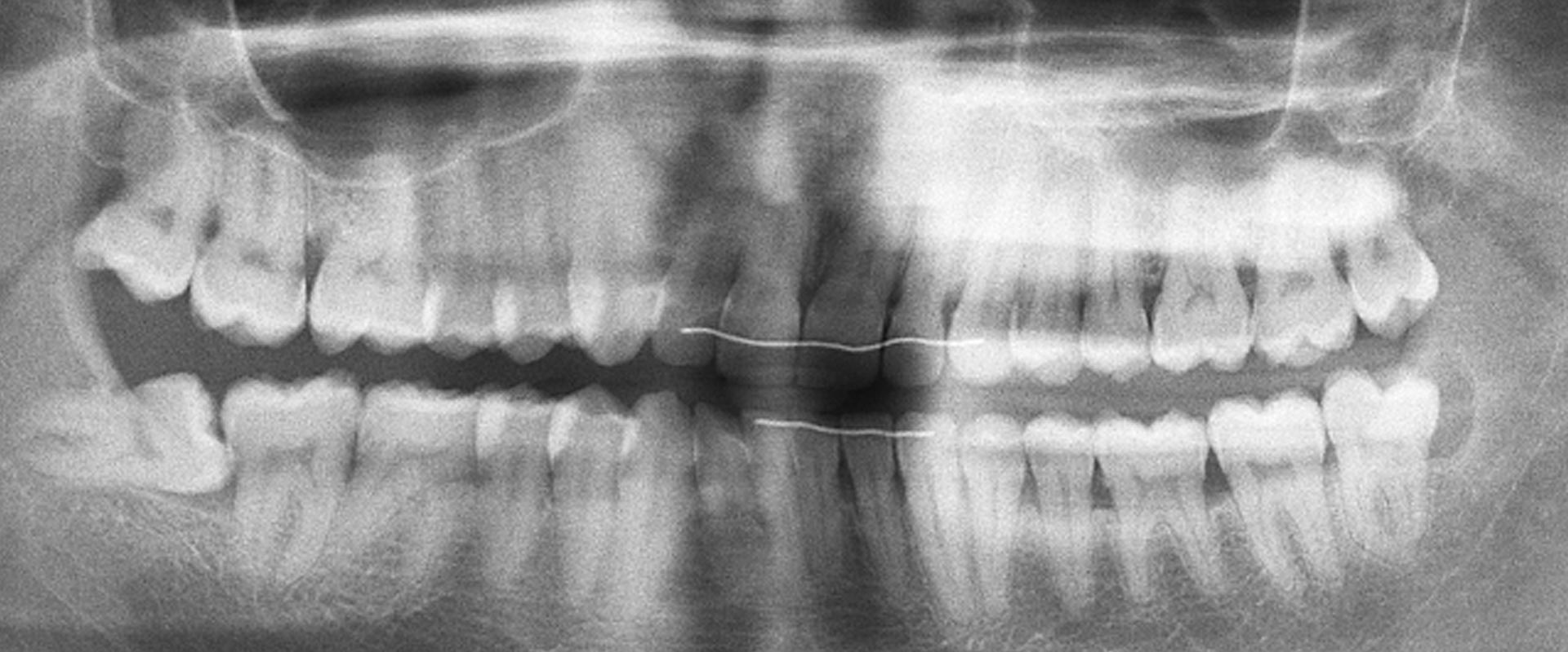 Digitales Röntgen bei Zahnarzt Frick med. Dent. Amberg & Amberg